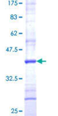 12.5% SDS-PAGE Stained with Coomassie Blue.