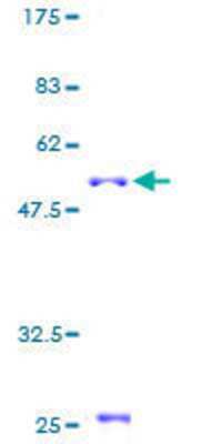 12.5% SDS-PAGE Stained with Coomassie Blue.