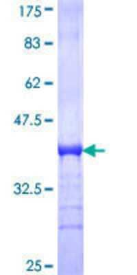 12.5% SDS-PAGE Stained with Coomassie Blue.