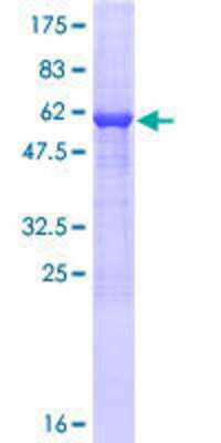 12.5% SDS-PAGE Stained with Coomassie Blue.