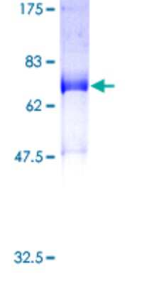 Other Recombinant Human SNX16 GST (N-Term) Protein