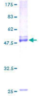 12.5% SDS-PAGE Stained with Coomassie Blue.