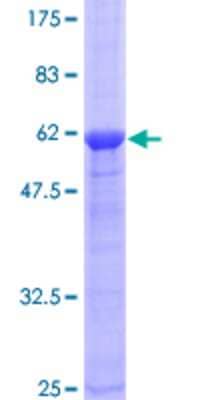 12.5% SDS-PAGE Stained with Coomassie Blue.