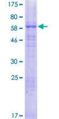 12.5% SDS-PAGE Stained with Coomassie Blue.