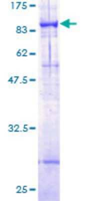 12.5% SDS-PAGE Stained with Coomassie Blue.