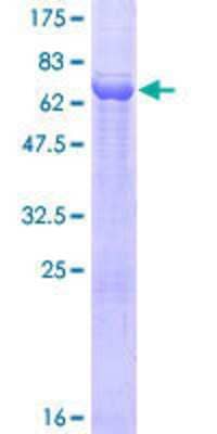 SDS-PAGE Recombinant Human DPEP2 GST (N-Term) Protein