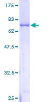 12.5% SDS-PAGE Stained with Coomassie Blue.