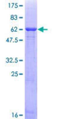 12.5% SDS-PAGE Stained with Coomassie Blue.