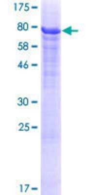 12.5% SDS-PAGE Stained with Coomassie Blue.