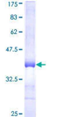 12.5% SDS-PAGE Stained with Coomassie Blue.