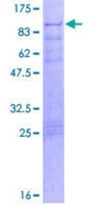 12.5% SDS-PAGE Stained with Coomassie Blue.