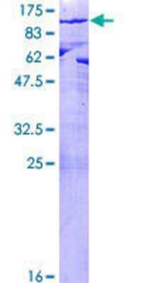 Other Recombinant Human PALS1/MPP5 GST (N-Term) Protein