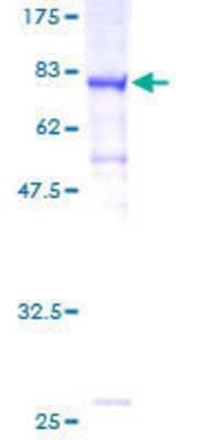 12.5% SDS-PAGE Stained with Coomassie Blue.