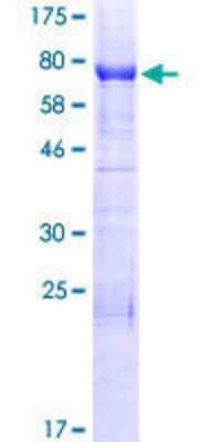SDS-PAGE Recombinant Human INF2 GST (N-Term) Protein