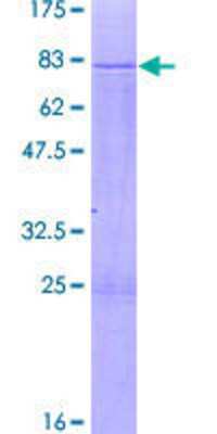 12.5% SDS-PAGE Stained with Coomassie Blue.