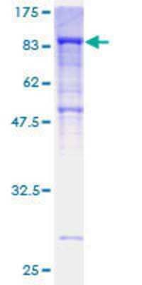Other Recombinant Human Dynein intermediate chain 2 GST (N-Term) Protein