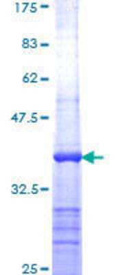 Other Recombinant Human Apc1 GST (N-Term) Protein