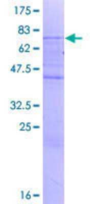 SDS-Page: Recombinant Human SMAP2 Protein [H00064744-P01] - 12.5% SDS-PAGE Stained with Coomassie Blue.