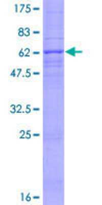 12.5% SDS-PAGE Stained with Coomassie Blue.