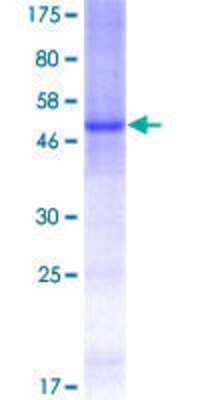 Other Recombinant Human Ceramide Kinase GST (N-Term) Protein