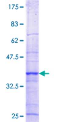 12.5% SDS-PAGE Stained with Coomassie Blue.