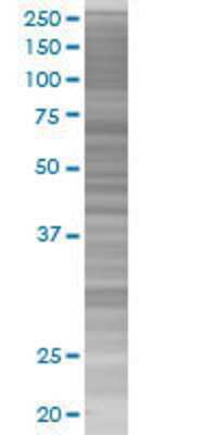 RBM15 transfected lysate.