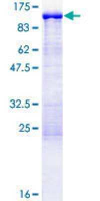 Other Recombinant Human EPS8L2 GST (N-Term) Protein