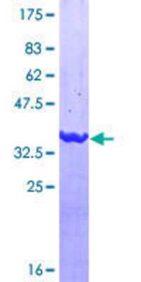 12.5% SDS-PAGE Stained with Coomassie Blue.