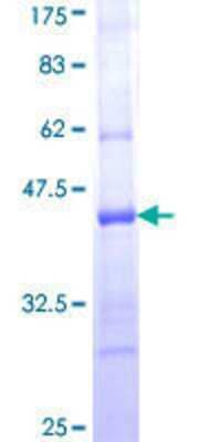 12.5% SDS-PAGE Stained with Coomassie Blue.