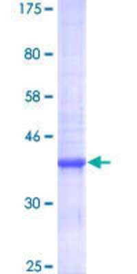 Other Recombinant Human SLC30A5 GST (N-Term)  Protein