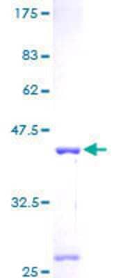 12.5% SDS-PAGE Stained with Coomassie Blue.