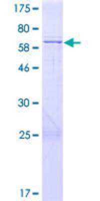 12.5% SDS-PAGE Stained with Coomassie Blue.