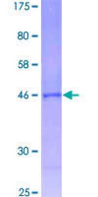 12.5% SDS-PAGE Stained with Coomassie Blue.