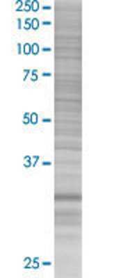 MRPL1 transfected lysate.