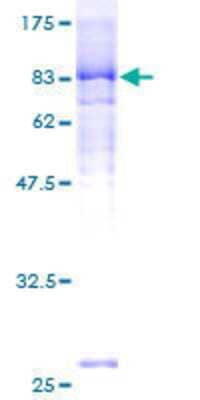 12.5% SDS-PAGE Stained with Coomassie Blue.