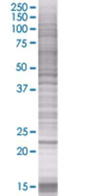 NOL6 transfected lysate.