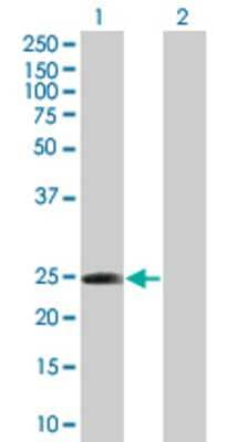 Lane 1: NOL6 transfected lysate (22.11 KDa) Lane 2: Non-transfected lysate.