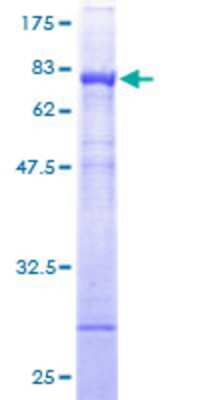 SDS-Page: Recombinant Human NADK Protein [H00065220-P01] - 12.5% SDS-PAGE Stained with Coomassie Blue.