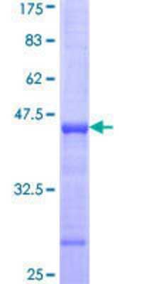 12.5% SDS-PAGE Stained with Coomassie Blue.