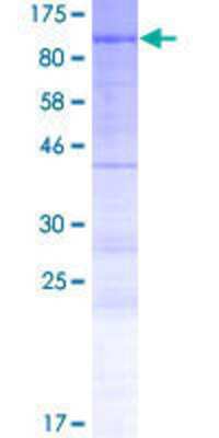 12.5% SDS-PAGE Stained with Coomassie Blue.