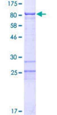 12.5% SDS-PAGE Stained with Coomassie Blue.
