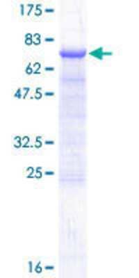 12.5% SDS-PAGE Stained with Coomassie Blue.