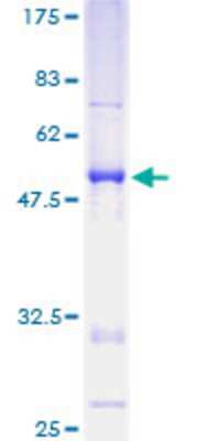 12.5% SDS-PAGE Stained with Coomassie Blue.