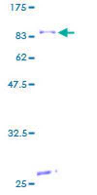 12.5% SDS-PAGE Stained with Coomassie Blue.