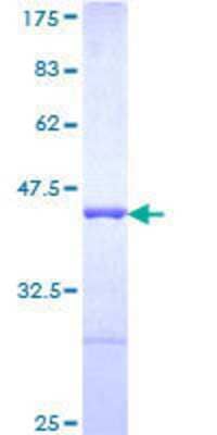 Other Recombinant Human AHNAK GST (N-Term) Protein