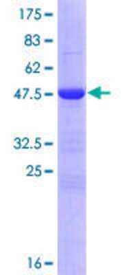 12.5% SDS-PAGE Stained with Coomassie Blue.