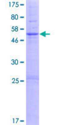 12.5% SDS-PAGE Stained with Coomassie Blue.