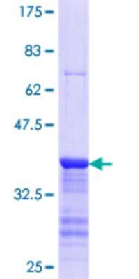 SDS-Page: Recombinant Human SECISBP2 Protein [H00079048-Q01] - 12.5% SDS-PAGE Stained with Coomassie Blue.