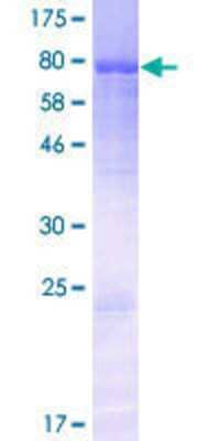 12.5% SDS-PAGE Stained with Coomassie Blue.