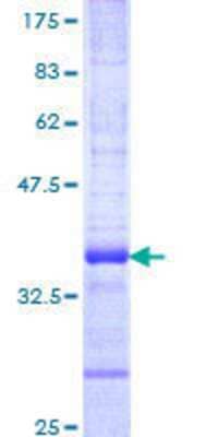 SDS-Page: Recombinant Human RNF26 Protein [H00079102-Q01] - 12.5% SDS-PAGE Stained with Coomassie Blue.